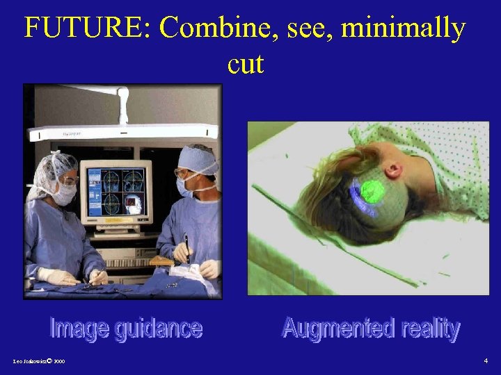 FUTURE: Combine, see, minimally cut Leo Joskowicz© 2000 4 