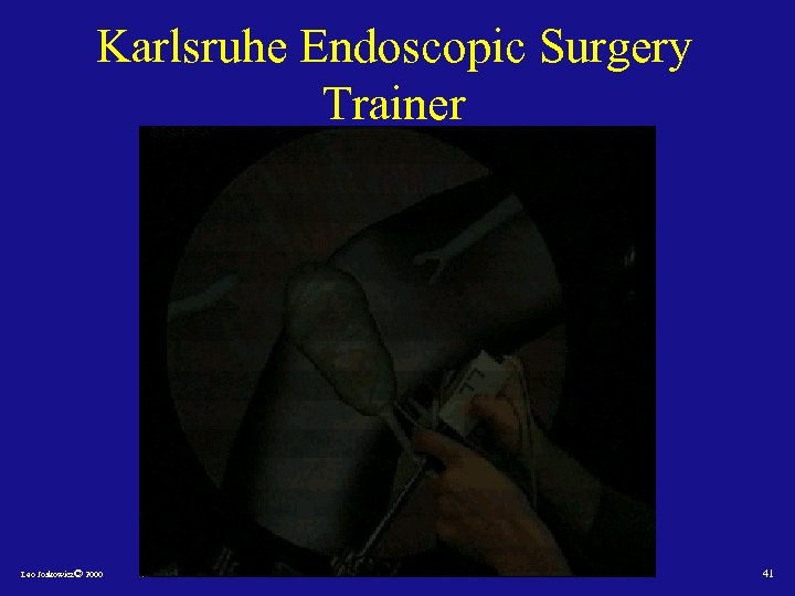 Karlsruhe Endoscopic Surgery Trainer Leo Joskowicz© 2000 41 