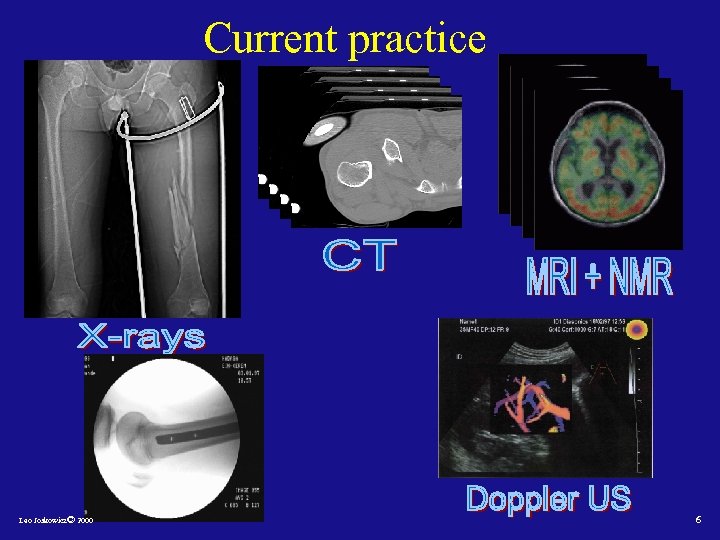 Current practice Leo Joskowicz© 2000 6 