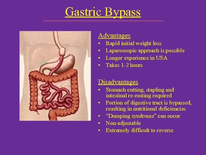 Gastric Bypass Advantages • • Rapid initial weight loss Laparoscopic approach is possible Longer