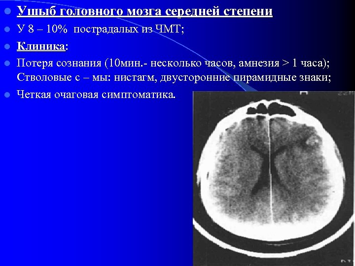 l Ушыб головного мозга середней степени У 8 – 10% пострадалых из ЧМТ; l