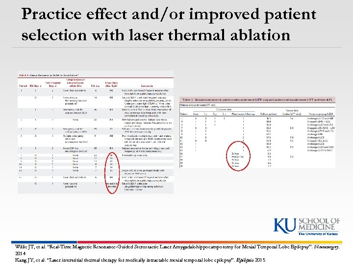 Practice effect and/or improved patient selection with laser thermal ablation Willie JT, et al.