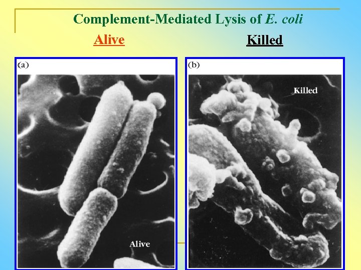 Complement-Mediated Lysis of E. coli Alive Killed 