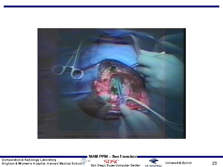 Computational Radiology Laboratory Brigham & Women’s Hospital, Harvard Medical School SIAM PP 06 –