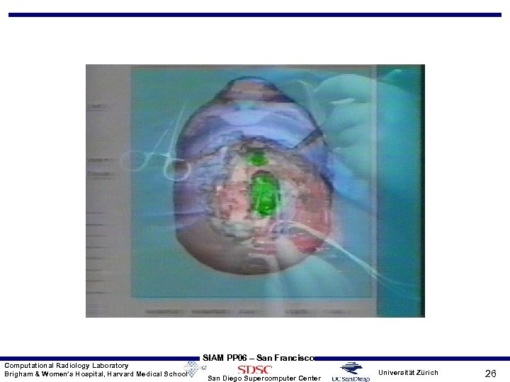 Computational Radiology Laboratory Brigham & Women’s Hospital, Harvard Medical School SIAM PP 06 –