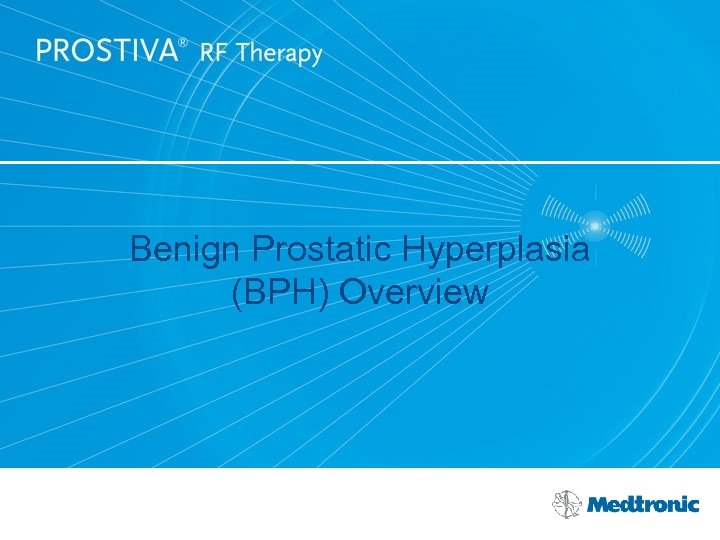 Benign Prostatic Hyperplasia (BPH) Overview 