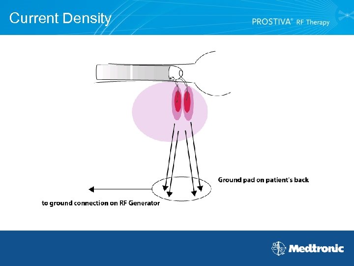 Current Density 