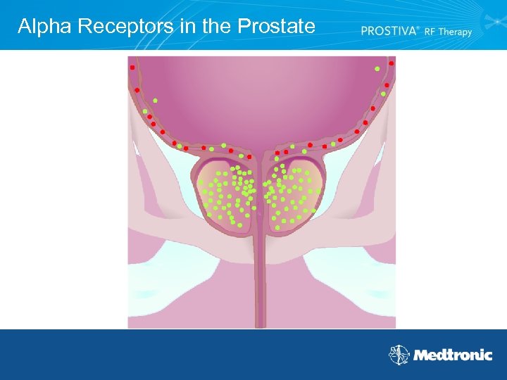 Alpha Receptors in the Prostate 