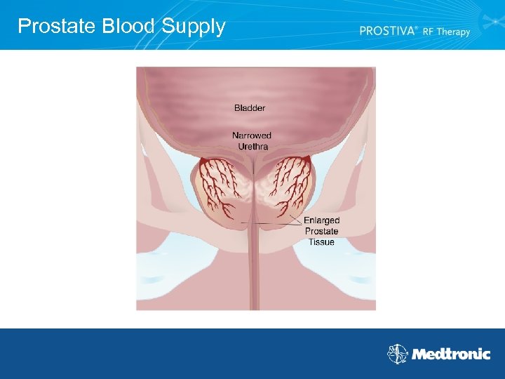 Prostate Blood Supply 