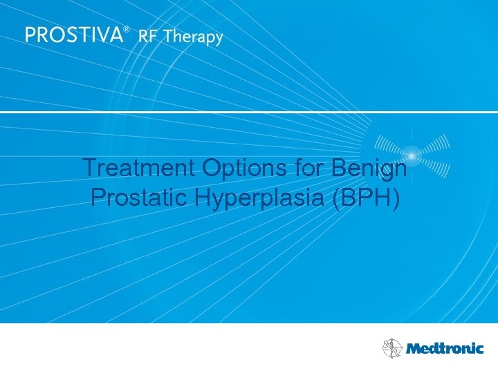 Treatment Options for Benign Prostatic Hyperplasia (BPH) 