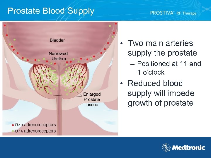Prostate Blood Supply • Two main arteries supply the prostate – Positioned at 11