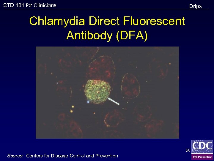 STD 101 for Clinicians Drips Chlamydia Direct Fluorescent Antibody (DFA) 50 Source: Centers for