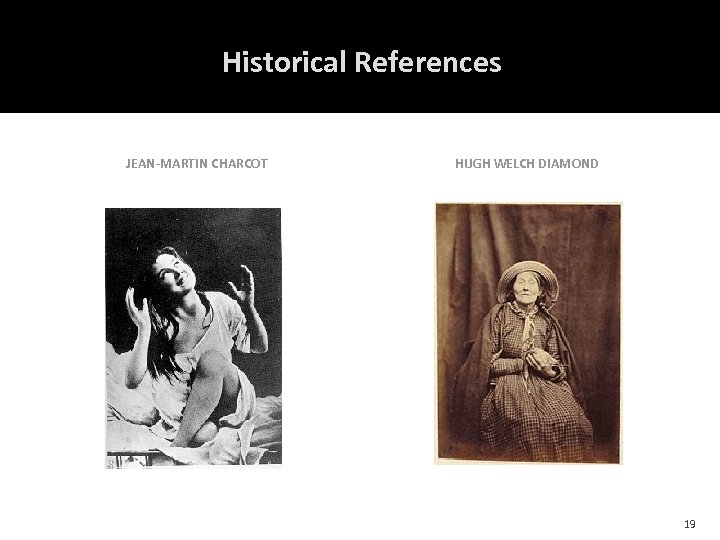 Historical References JEAN-MARTIN CHARCOT HUGH WELCH DIAMOND 19 