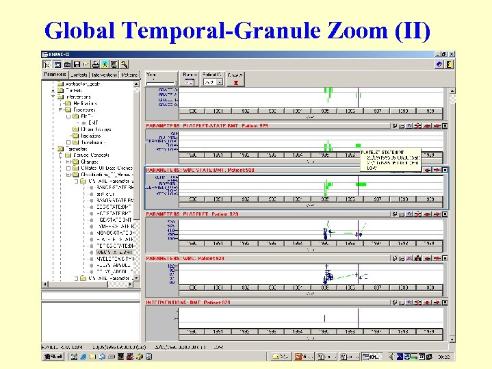 Global Temporal-Granule Zoom (II) 