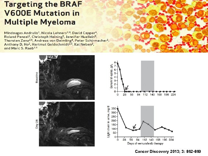 Cancer Discovery 2013; 3: 862 -869 