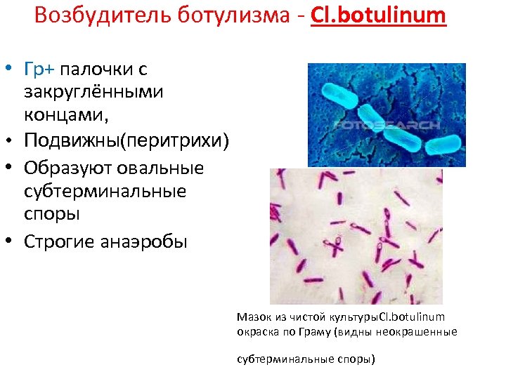 Возбудитель ботулизма - Cl. botulinum • Гр+ палочки с закруглёнными концами, • Подвижны(перитрихи) •