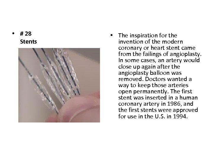  • # 28 Stents • The inspiration for the invention of the modern