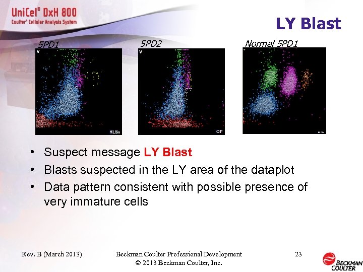 LY Blast 5 PD 1 5 PD 2 Normal 5 PD 1 • Suspect