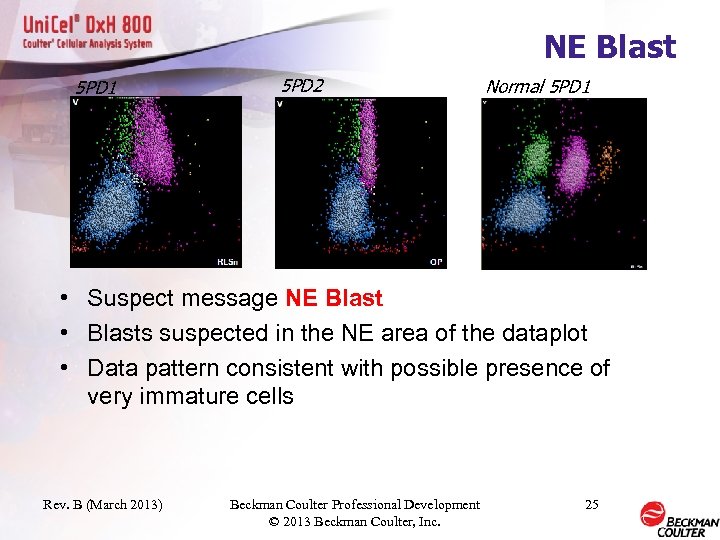 NE Blast 5 PD 1 5 PD 2 Normal 5 PD 1 • Suspect