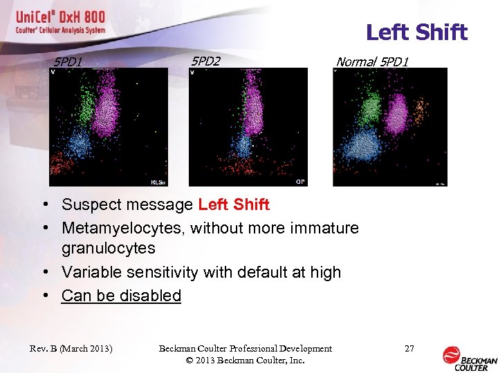 Left Shift 5 PD 1 5 PD 2 Normal 5 PD 1 • Suspect