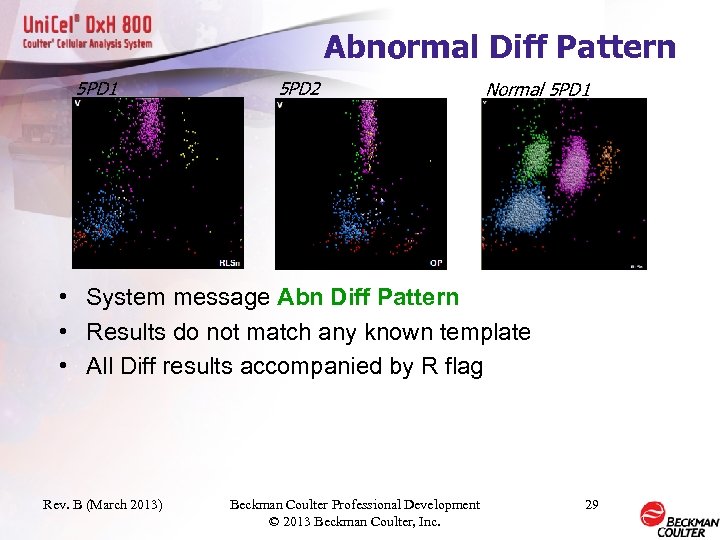 Abnormal Diff Pattern 5 PD 1 5 PD 2 Normal 5 PD 1 •