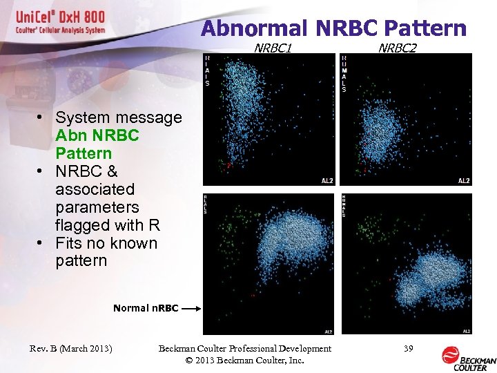 Abnormal NRBC Pattern NRBC 1 NRBC 2 • System message Abn NRBC Pattern •