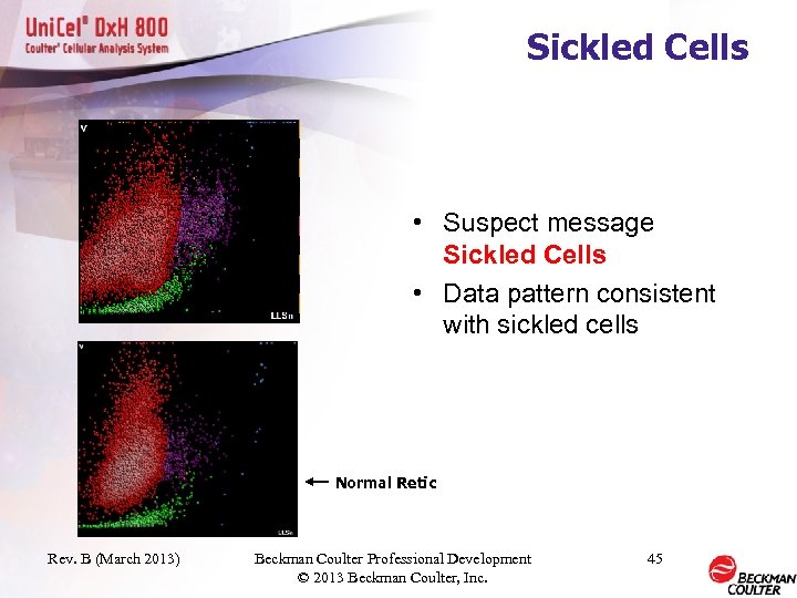 Sickled Cells • Suspect message Sickled Cells • Data pattern consistent with sickled cells