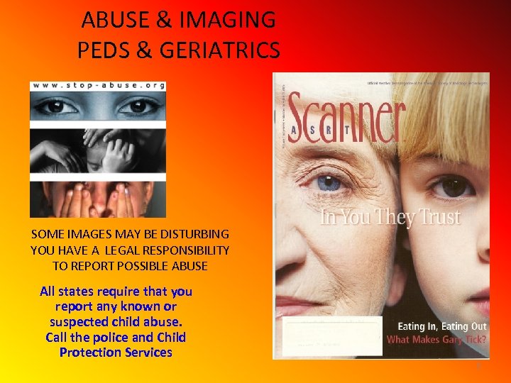 ABUSE & IMAGING PEDS & GERIATRICS SOME IMAGES MAY BE DISTURBING YOU HAVE A