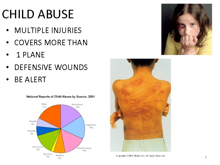 CHILD ABUSE • • • MULTIPLE INJURIES COVERS MORE THAN 1 PLANE DEFENSIVE WOUNDS
