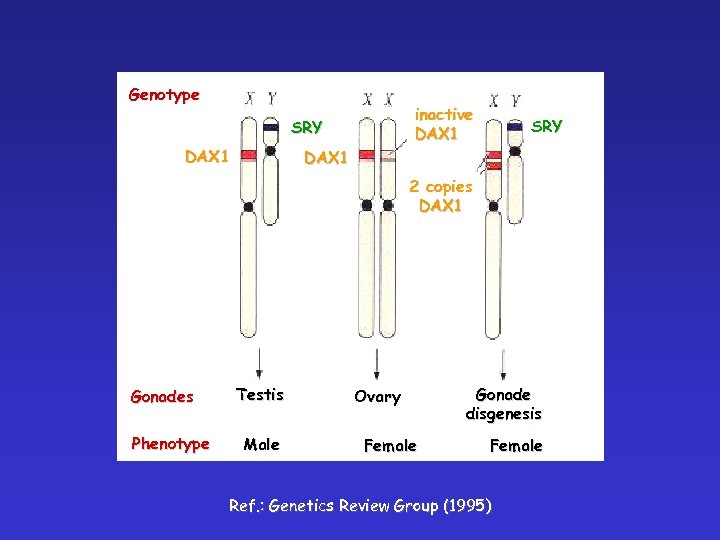 Genotype inactive DAX 1 SRY DAX 1 2 copies DAX 1 Gonades Phenotype Testis