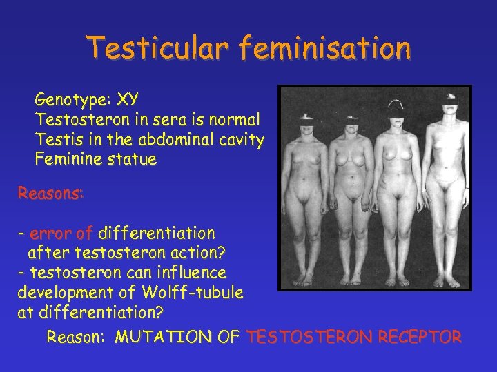 Testicular feminisation Genotype: XY Testosteron in sera is normal Testis in the abdominal cavity