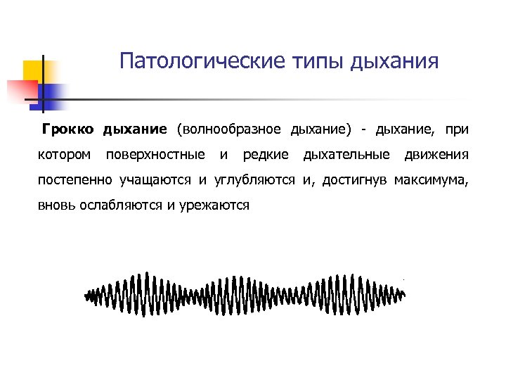 Патологическое дыхание рисунок