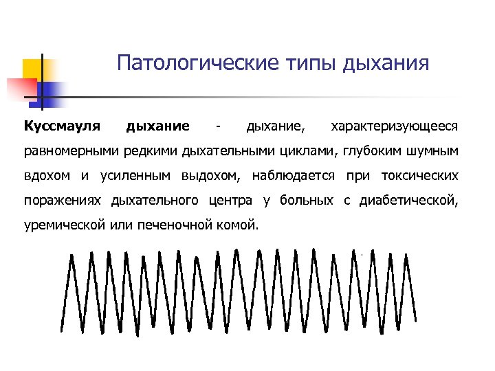 Патологическое дыхание рисунок