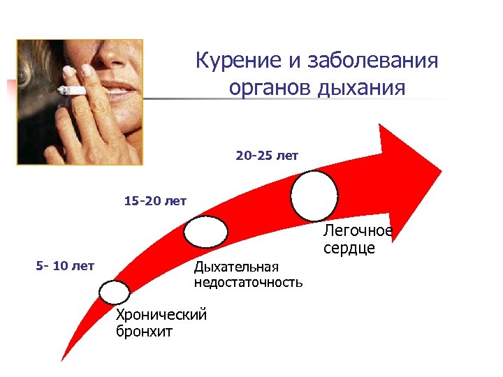 Курение и заболевания органов дыхания 20 -25 лет 15 -20 лет Легочное сердце 5