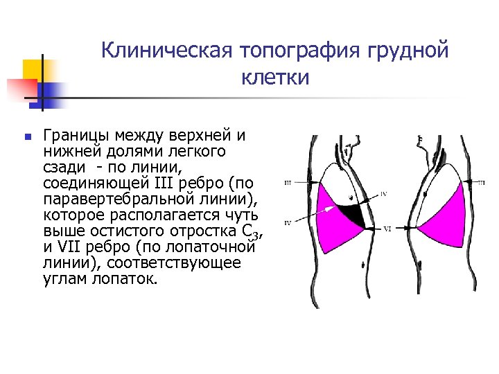 Клиническая топография грудной клетки n Границы между верхней и нижней долями легкого сзади -