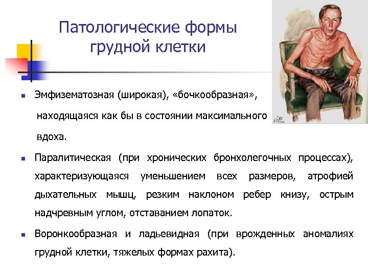 Патологические формы грудной клетки n Эмфизематозная (широкая), «бочкообразная» , находящаяся как бы в состоянии