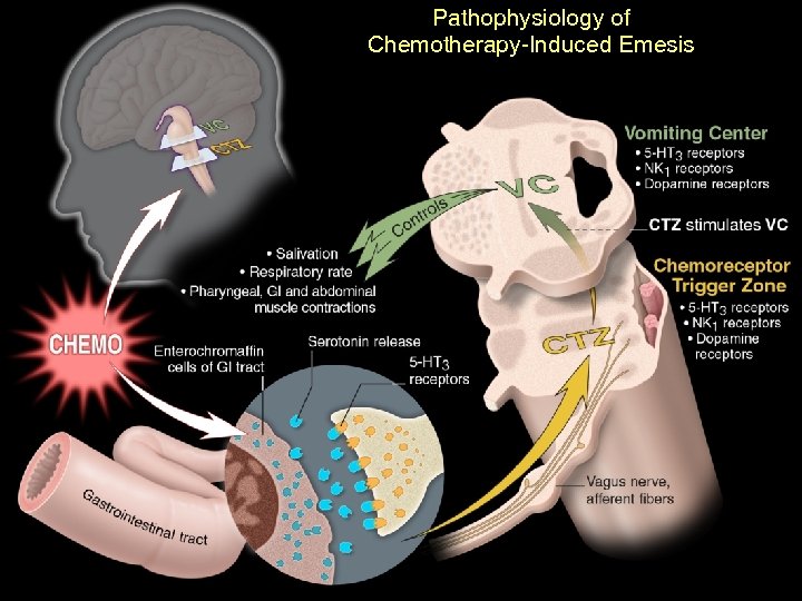 Pathophysiology of Chemotherapy-Induced Emesis 