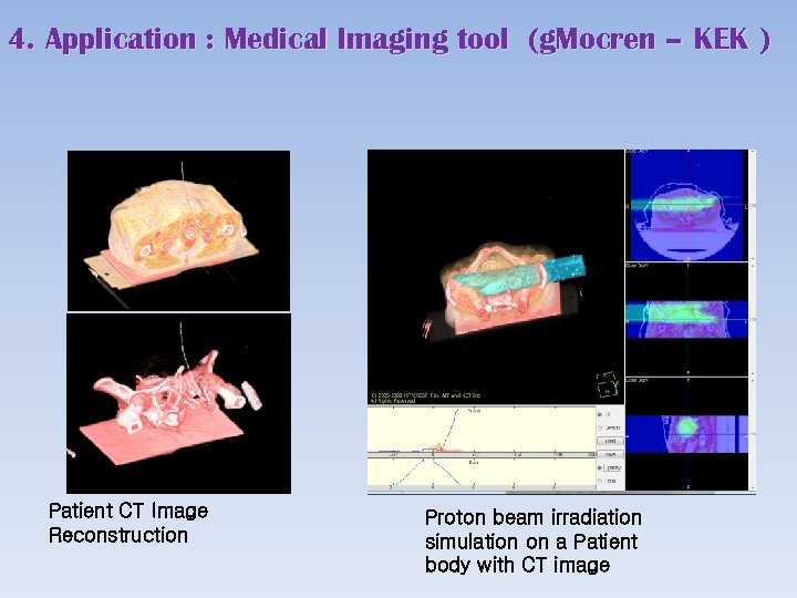 4. Application : Medical Imaging tool (g. Mocren – KEK ) Patient CT Image
