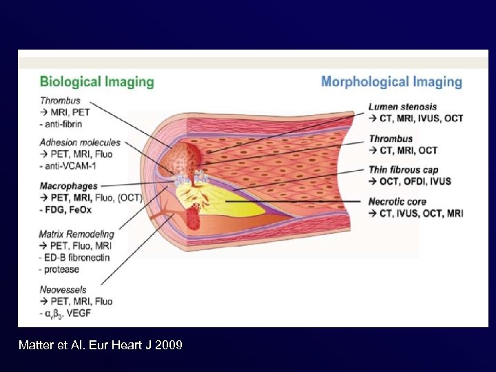 Matter et Al. Eur Heart J 2009 