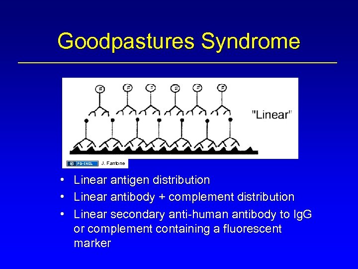 Goodpastures Syndrome J. Fantone • • • Linear antigen distribution Linear antibody + complement