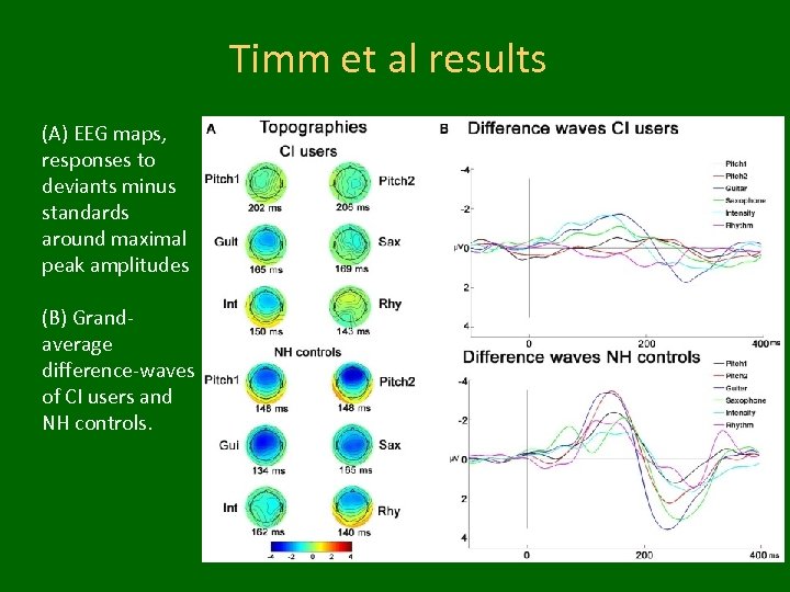 Timm et al results (A) EEG maps, responses to deviants minus standards around maximal