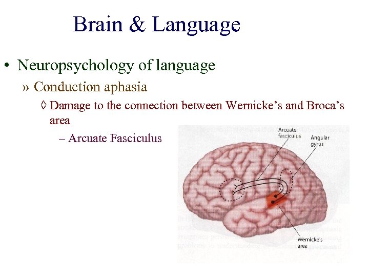 Brain & Language • Neuropsychology of language » Conduction aphasia ◊ Damage to the