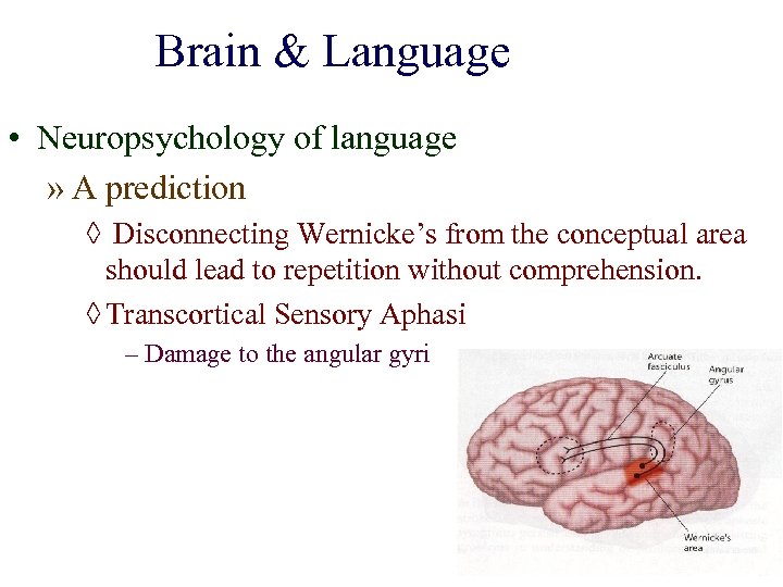 Brain & Language • Neuropsychology of language » A prediction ◊ Disconnecting Wernicke’s from