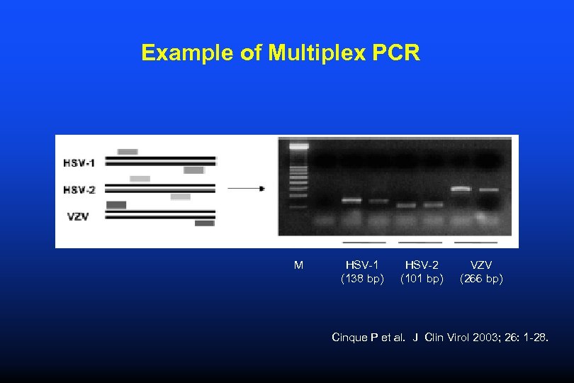 Example of Multiplex PCR M HSV-1 (138 bp) HSV-2 (101 bp) VZV (266 bp)