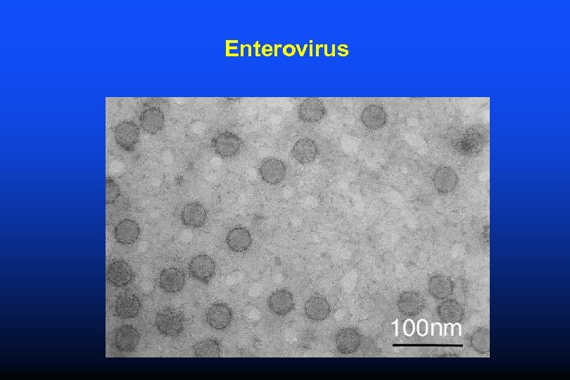 Enterovirus 