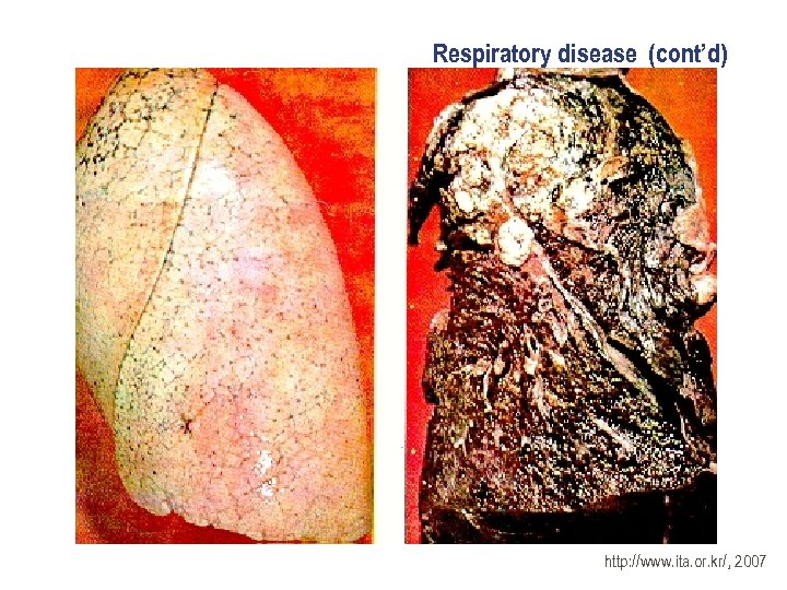 Respiratory disease (cont’d) http: //www. ita. or. kr/, 2007 