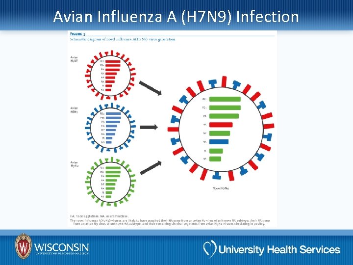 Avian Influenza A (H 7 N 9) Infection 