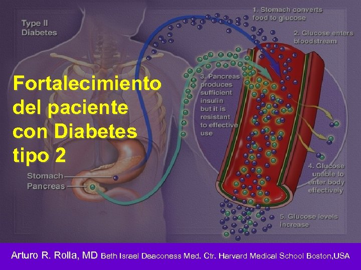 Fortalecimiento del paciente con Diabetes tipo 2 Arturo R. Rolla, MD Beth Israel Deaconess