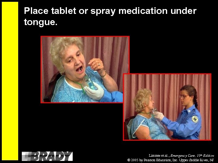 Place tablet or spray medication under tongue. Limmer et al. , Emergency Care, 10