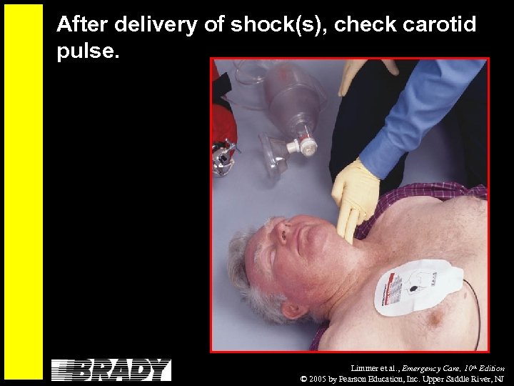 After delivery of shock(s), check carotid pulse. Limmer et al. , Emergency Care, 10